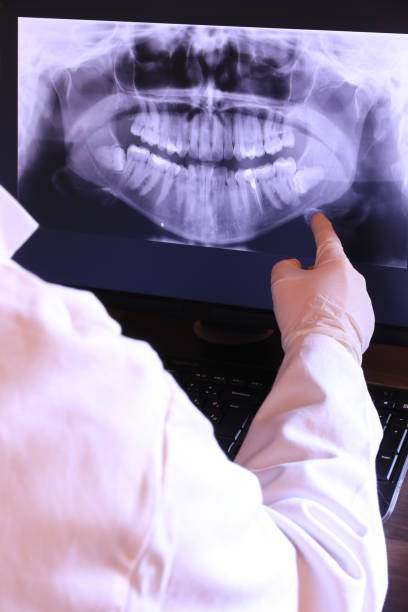 Best Emergency Root Canal Treatment in Ives Estates, FL